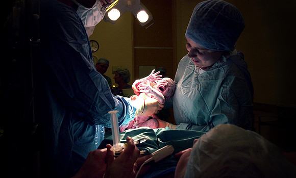 Caesarean section at the LRI